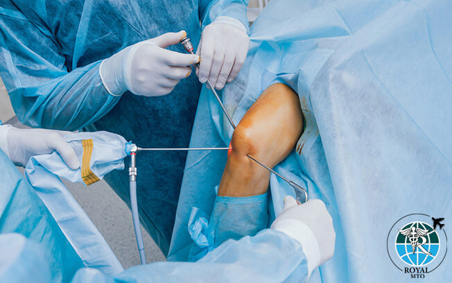 جراحی درمان پارگی مینیسک زانو